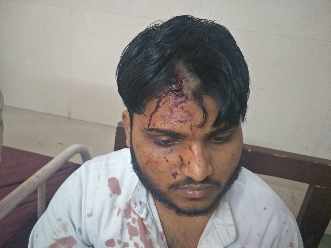 गंगोह का घायल गंगोह का घायल