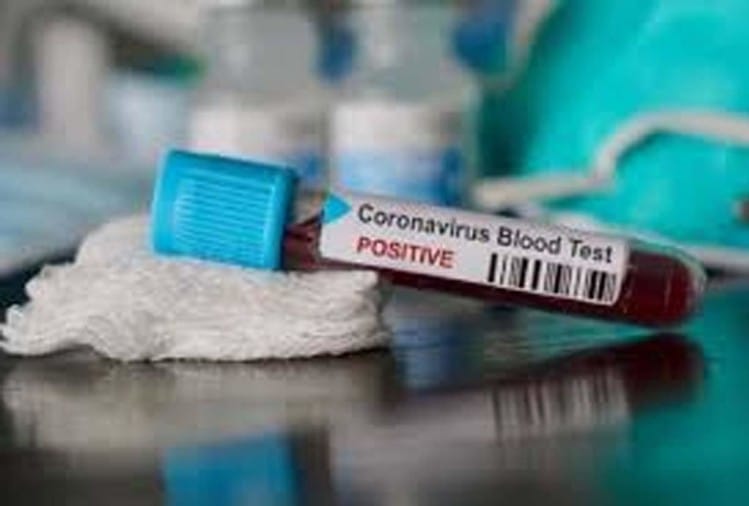 कोरोना वायरस।