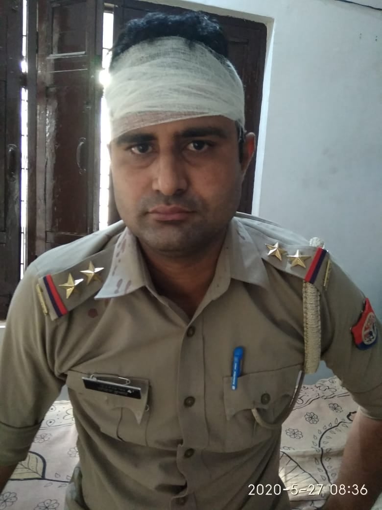 झिंझाना (शामली) क्षेत्र के गांव टपराना में दबिश के दौरान हुए हमले में घायल दरोगा सुनील तोमर। झिंझाना (शामली) क्षेत्र के गांव टपराना में दबिश के दौरान हुए हमले में घायल दरोगा सुनील तोमर।
