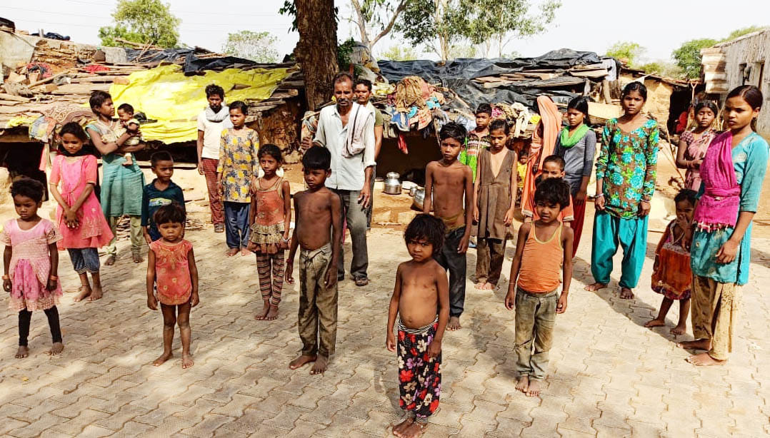 चेचक की बीमारी से ग्रसित बच्चे चेचक की बीमारी से ग्रसित बच्चे