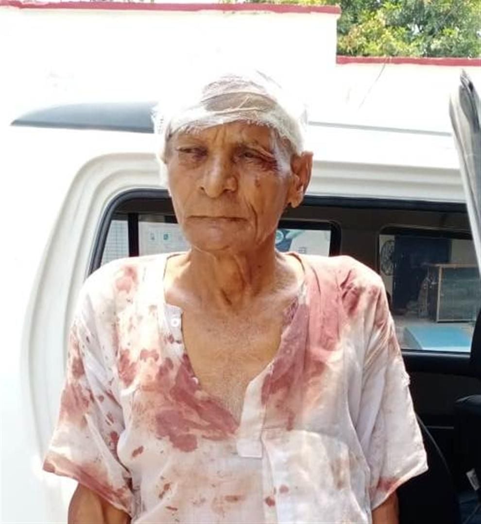 मारपीट में घायल दूसरे पक्ष के लोग। मारपीट में घायल दूसरे पक्ष के लोग।