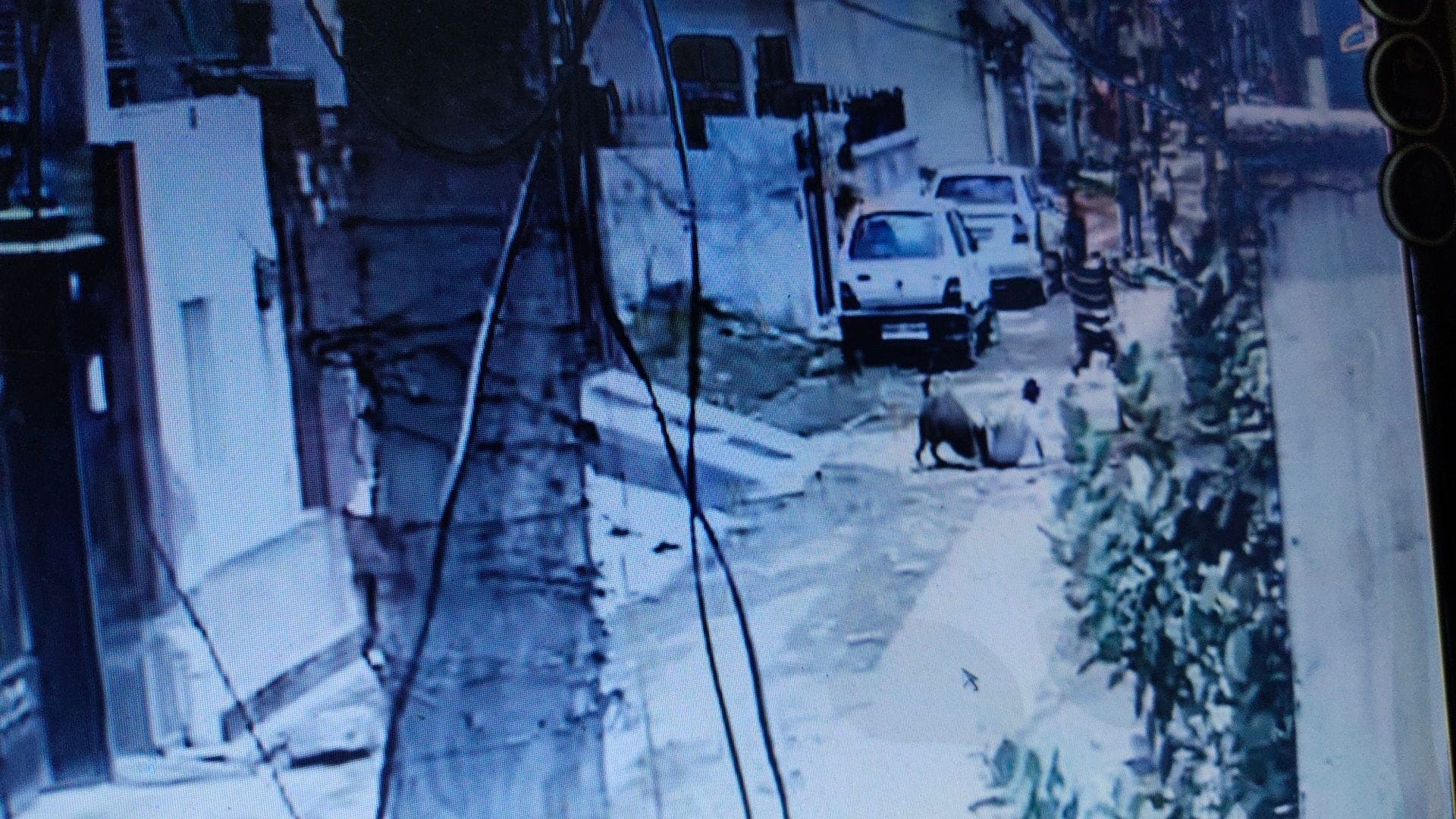 dog bite