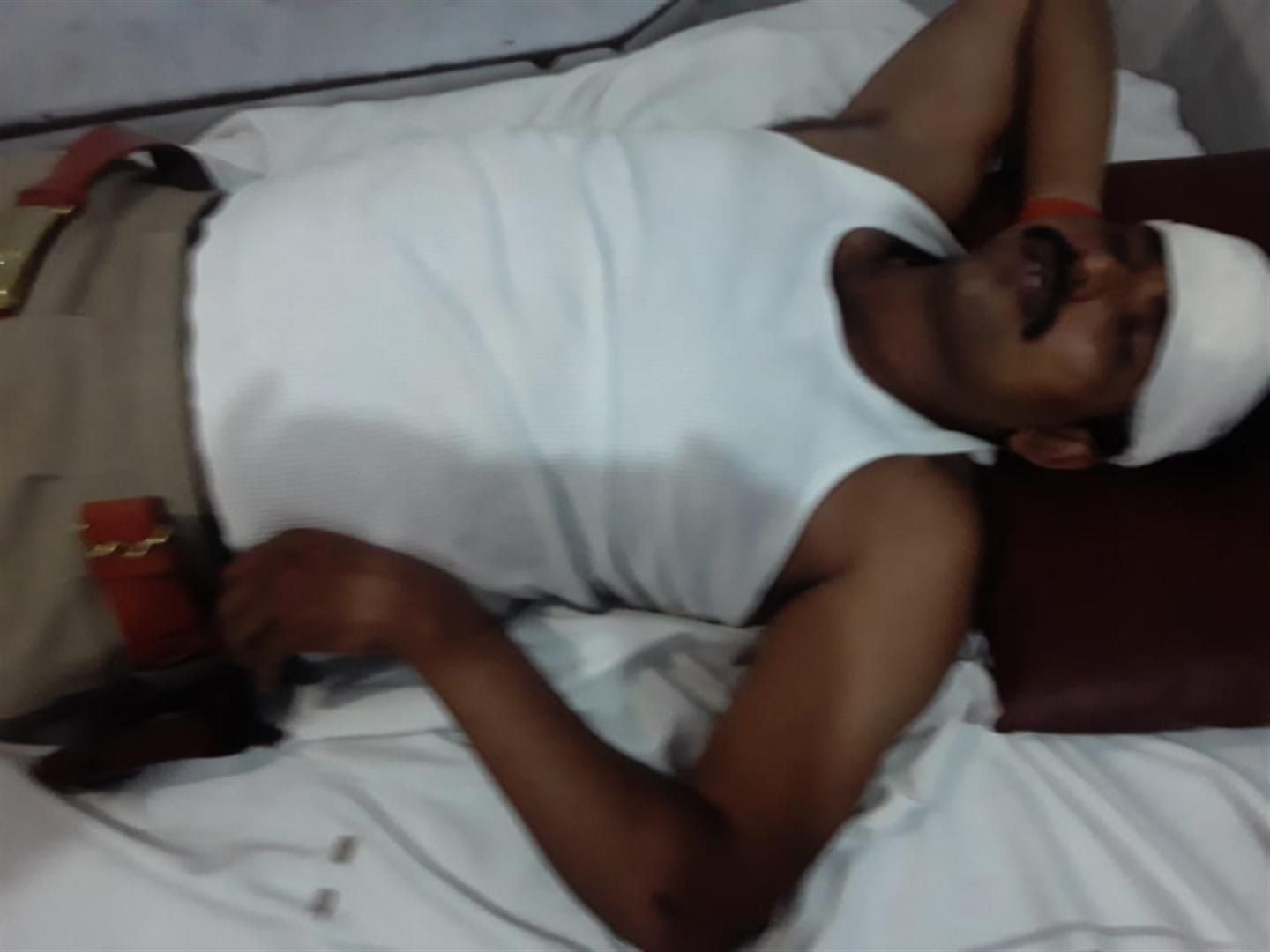 पथराव में घायल दरोगा।