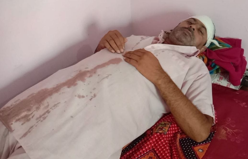 शराब ठेके पर हुए हमले में घायल अनिल। शराब ठेके पर हुए हमले में घायल अनिल।