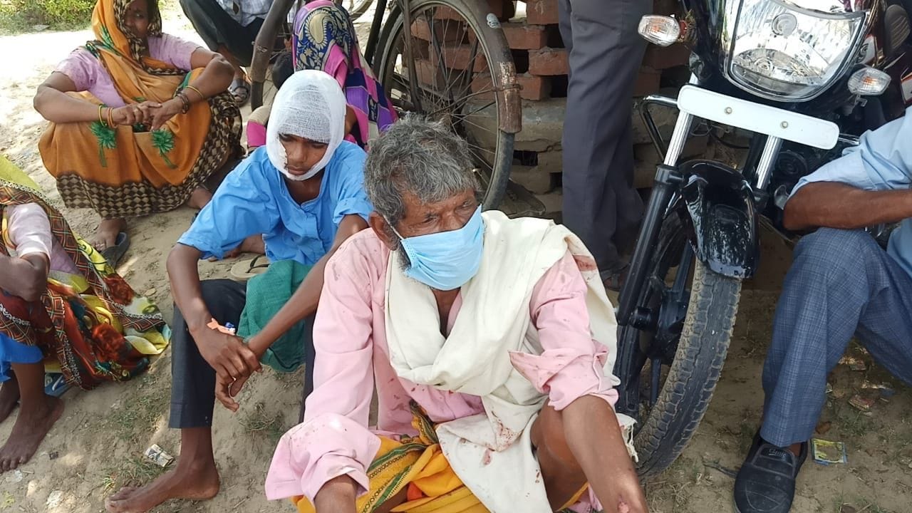नगला देवराय में माता पथवारी के मंदिर की जमीन पर कब्जा किए जाने को लेकर हुई मारपीट के घायल नगला देवराय में माता पथवारी के मंदिर की जमीन पर कब्जा किए जाने को लेकर हुई मारपीट के घायल