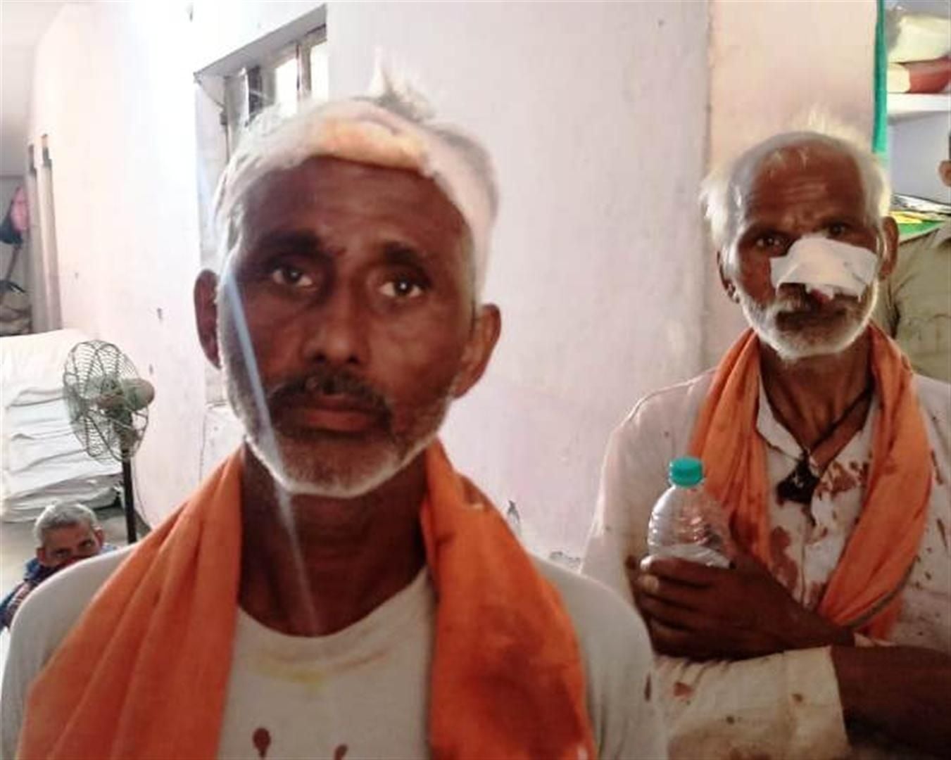 मारपीट में घायल वृद्ध। मारपीट में घायल वृद्ध।