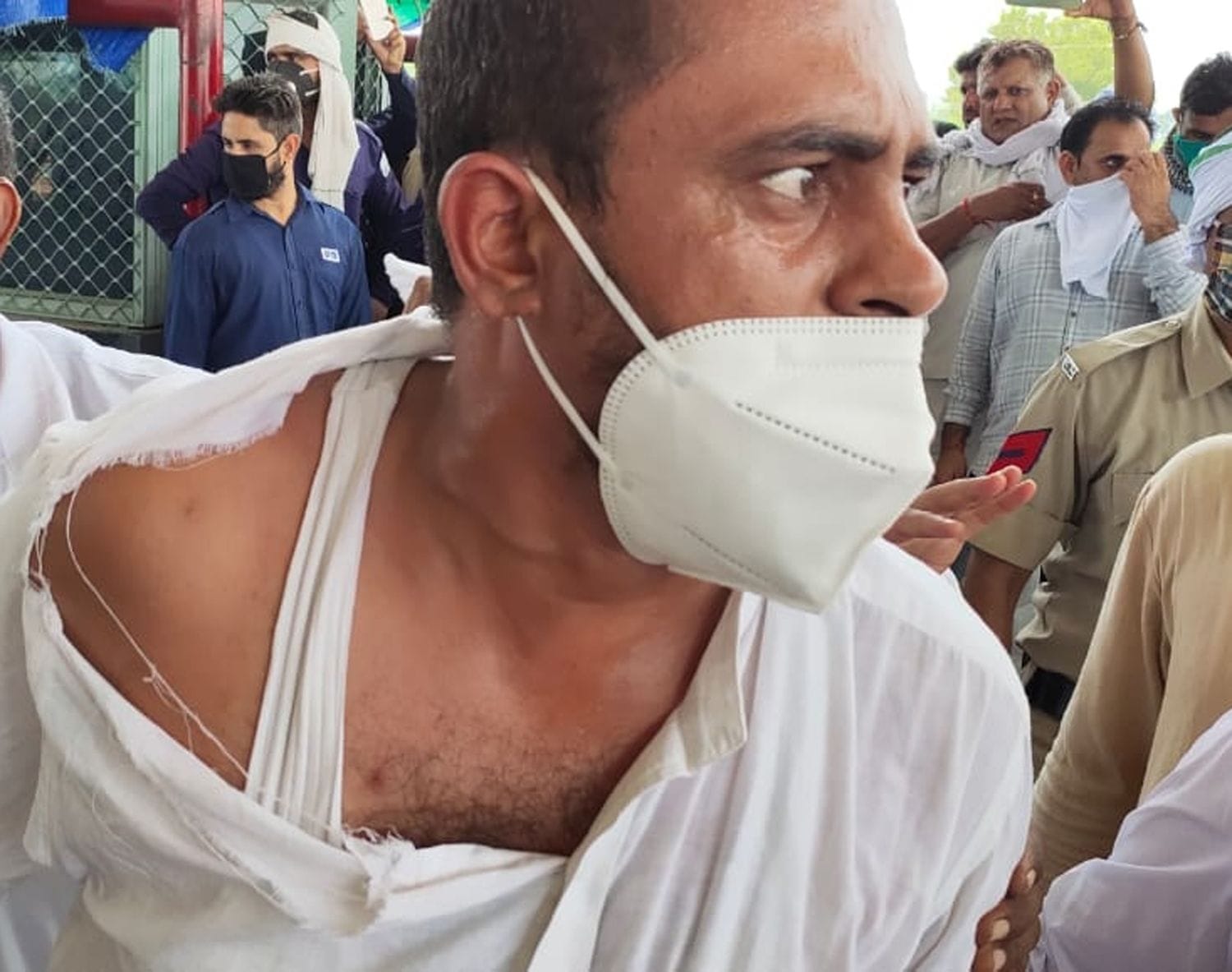 झड़प के दौरान फाड़े गए कपड़े को दिखाता टोल का कर्मचारी। झड़प के दौरान फाड़े गए कपड़े को दिखाता टोल का कर्मचारी।