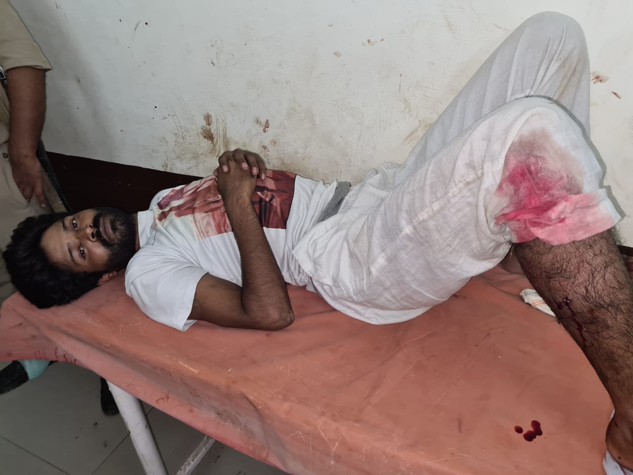 शामली आर्दशमंडी पुलिस द्वारा मुडेट में मुठभेड के बाद पकडा बदमाश शामली आर्दशमंडी पुलिस द्वारा मुडेट में मुठभेड के बाद पकडा बदमाश