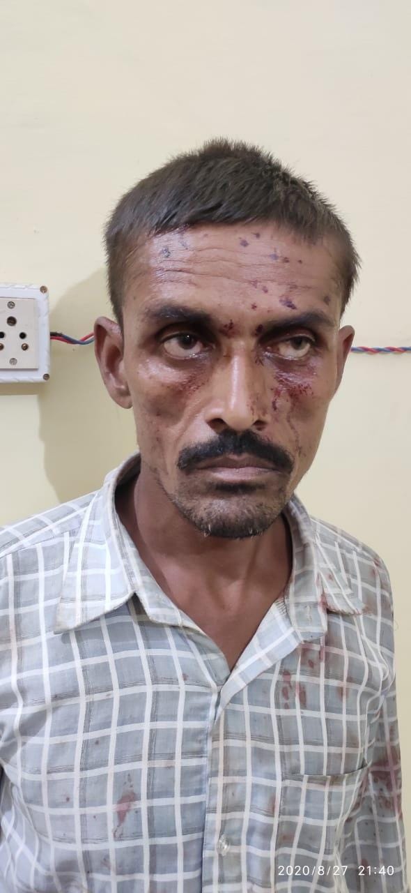 किं का पिता हत्यारोपी पिता प्रेम सिंह खून से सना चेहरा