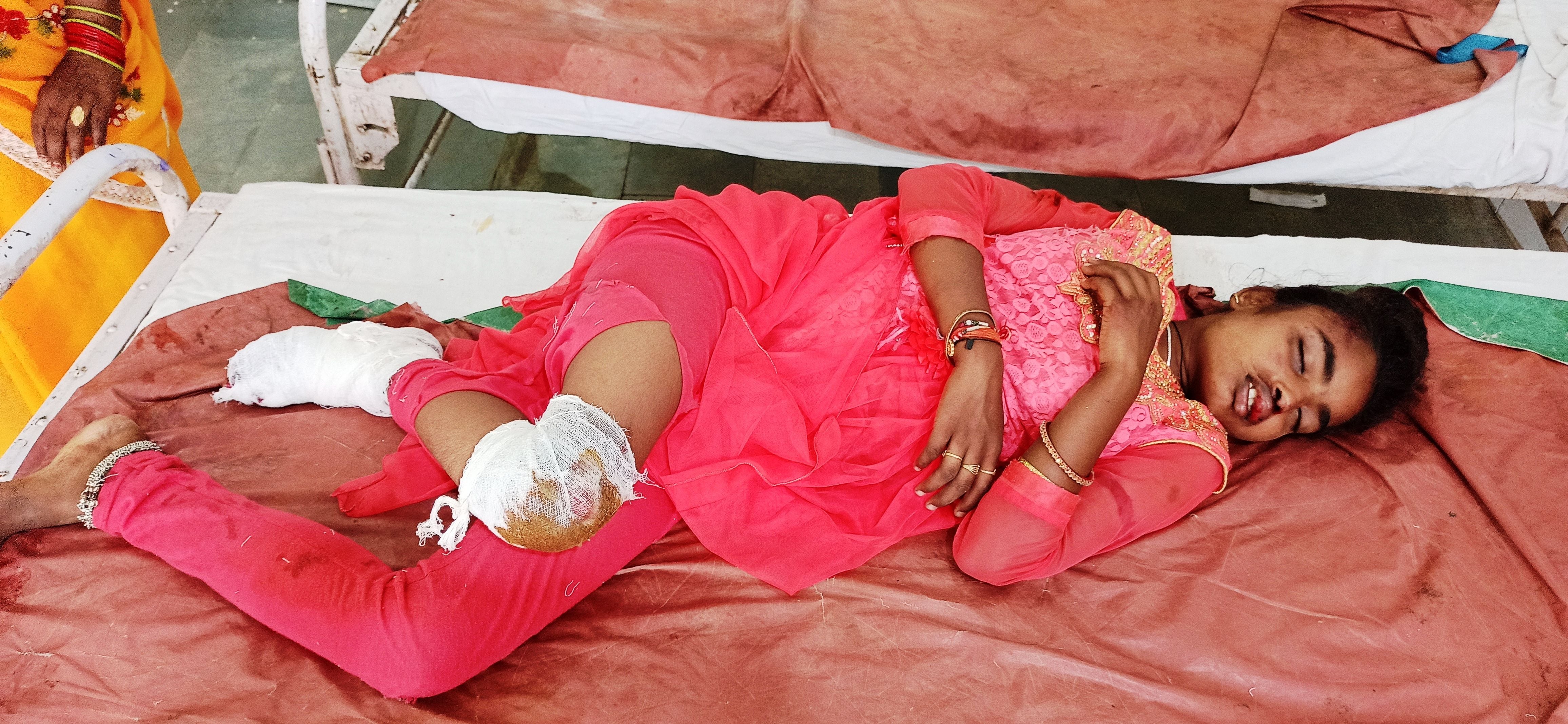 गंदे नाले के पास हुई बाइकों की भिंडत में घायल युवती गंदे नाले के पास हुई बाइकों की भिंडत में घायल युवती