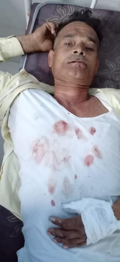 हाथरस: सहपऊ में मारपीट में घायल युवक। हाथरस: सहपऊ में मारपीट में घायल युवक।