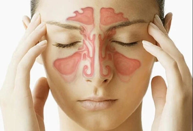 Sinus Causes Symptoms Types And Treatment In Hindi Sinus Infection Home Remedies Relief Without Antibiotics लग त र रहन व ल सर द ज क म ह सकत ह स इनस क लक षण ज न ए इस ब म र स