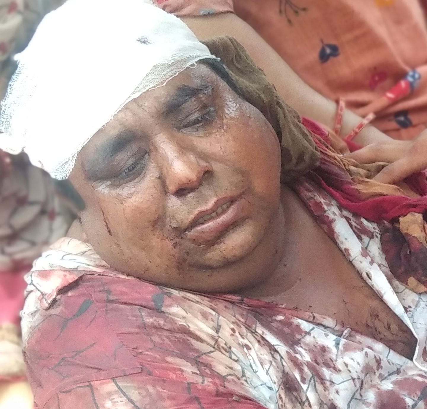 झगडे़ में घायल युवक झगडे़ में घायल युवक