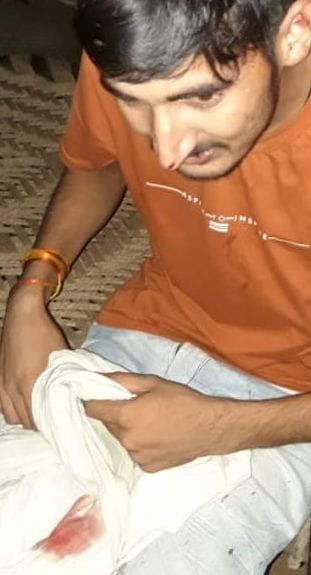 चौसाना क्षेत्र के गांव ऊदपुर में मारपीट से घायल युवक चौसाना क्षेत्र के गांव ऊदपुर में मारपीट से घायल युवक