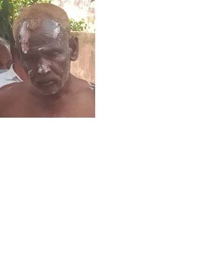 बीसलपुर के गांव अखौली के घर में लगी आग बुझाने में झुलसा ग्रामीण। बीसलपुर के गांव अखौली के घर में लगी आग बुझाने में झुलसा ग्रामीण।