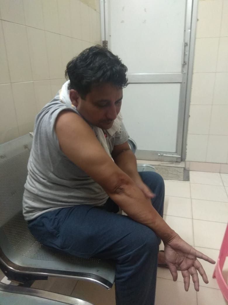 हमले में घायल वार्डर सुनील।