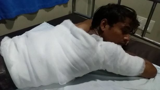 घायल आमिर जेएन मेडिकल कॉलेज में भर्ती । घायल आमिर जेएन मेडिकल कॉलेज में भर्ती ।