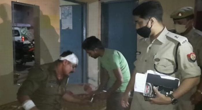 घायल सिपाही से बात करते एसपी सिटी। संवाद