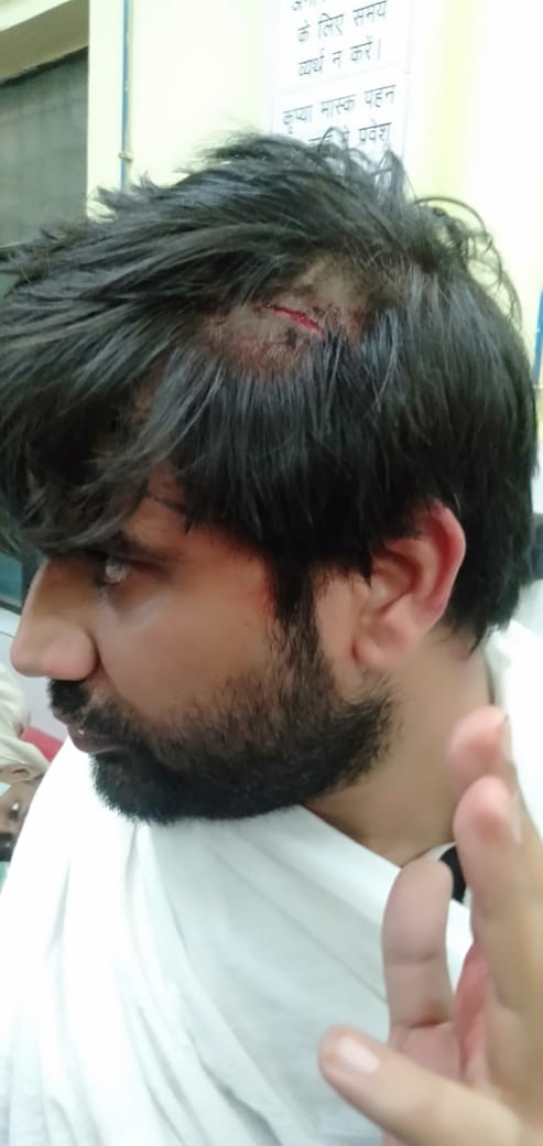 जिला चिकित्सालय में ईलाज को भर्ती गणपति ढाबे पर हमले में घायल।