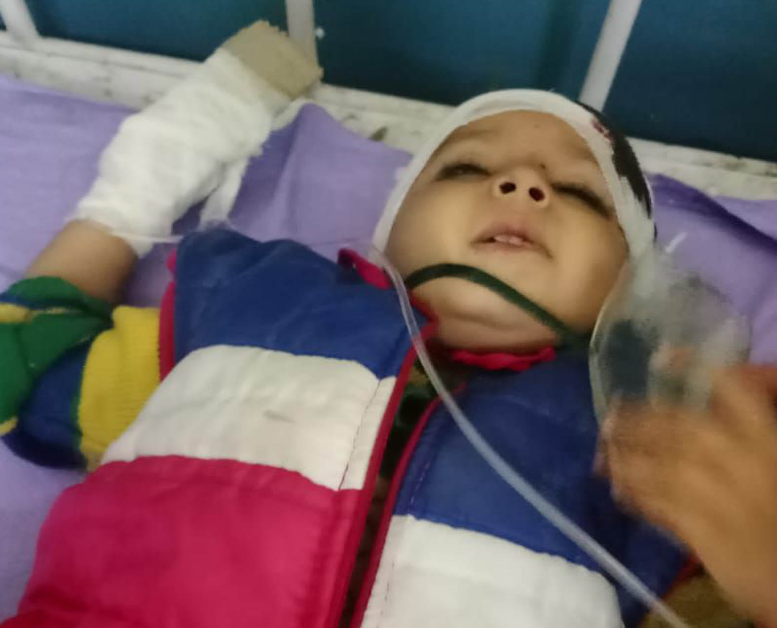 बांदा : जिला अस्पताल में भर्ती घायल बच्ची।