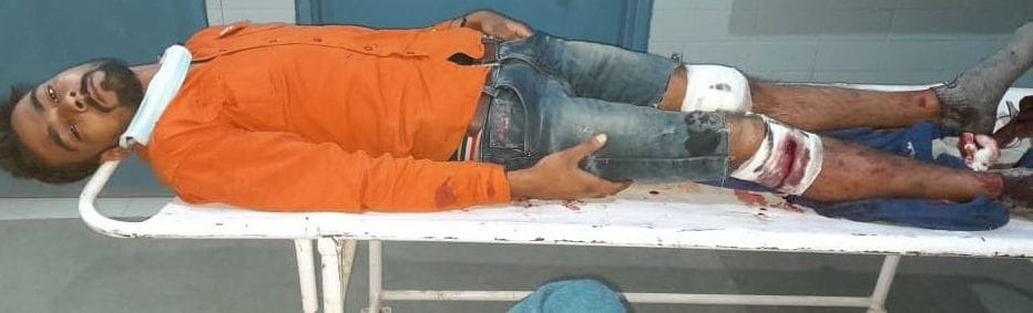 कांधला सीएचसी में भर्ती मुठभेड़ में घायल बदमाश