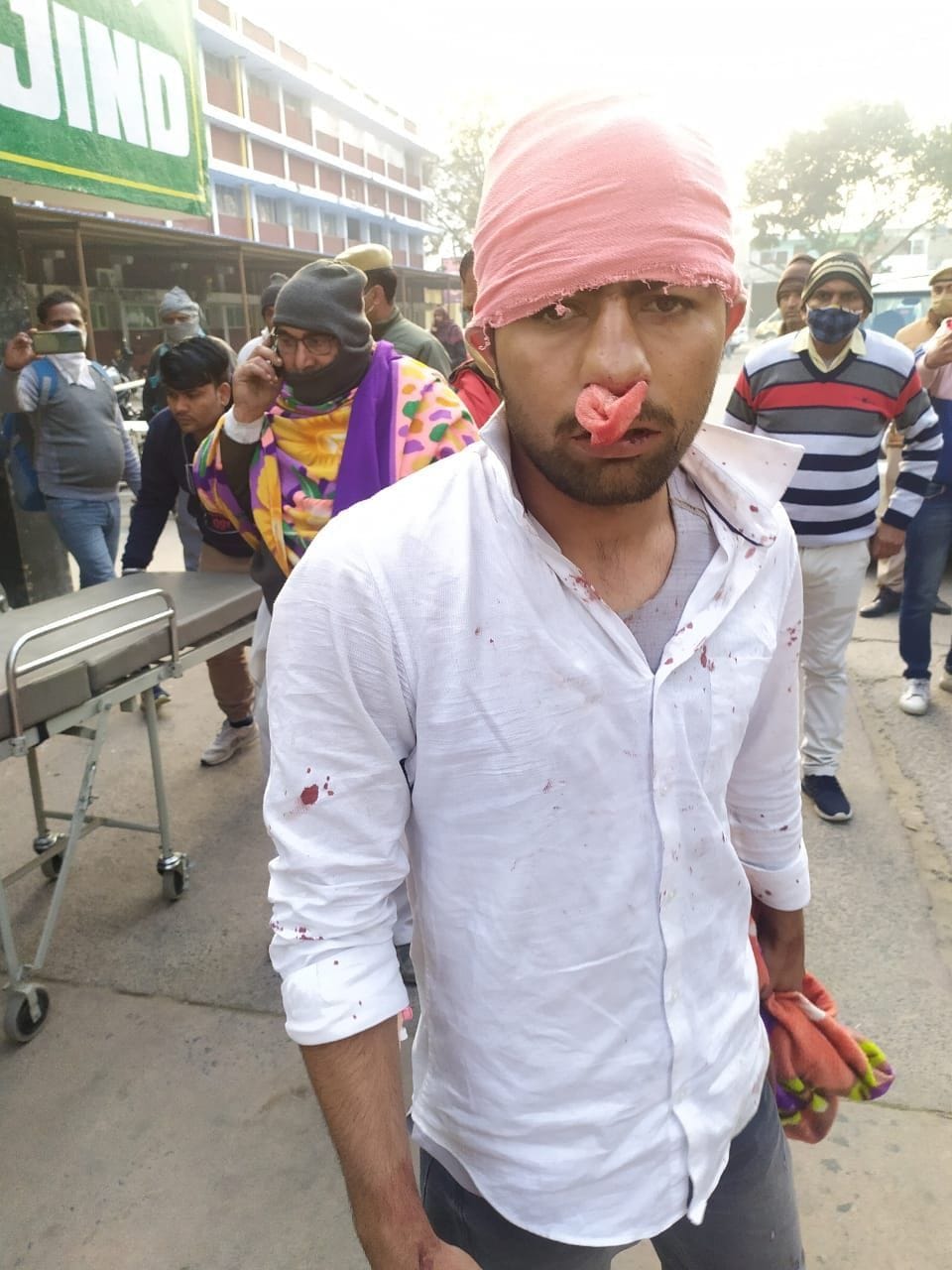 नंदगढ़ निवासी घायल आशीष। नंदगढ़ निवासी घायल आशीष।