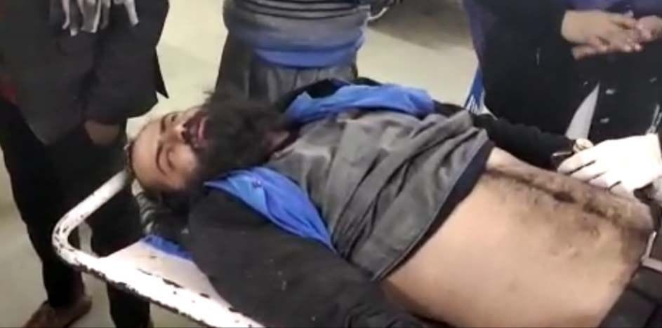 कोहडौर थाना क्षेत्र के मकुनपुर में बदमाशों की गोली से घायल युवक अब्दुल्ला। कोहडौर थाना क्षेत्र के मकुनपुर में बदमाशों की गोली से घायल युवक अब्दुल्ला।