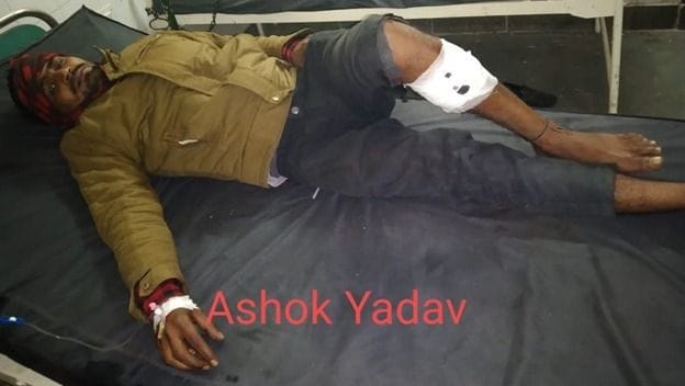जिला अस्पताल में भर्ती पुलिस मुठभेड़ में घायल अशोक यादव। जिला अस्पताल में भर्ती पुलिस मुठभेड़ में घायल अशोक यादव।