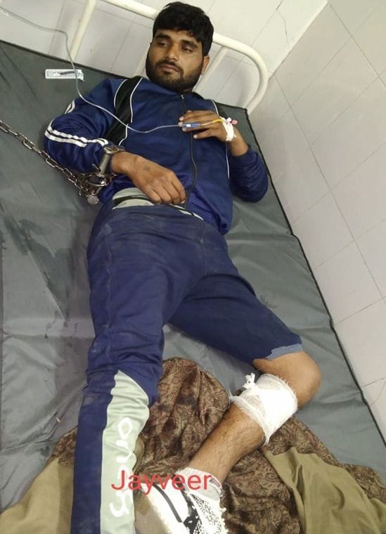 जिला अस्पताल में भर्ती पुलिस मुठभेड़ में घायल जयवीर । जिला अस्पताल में भर्ती पुलिस मुठभेड़ में घायल जयवीर ।