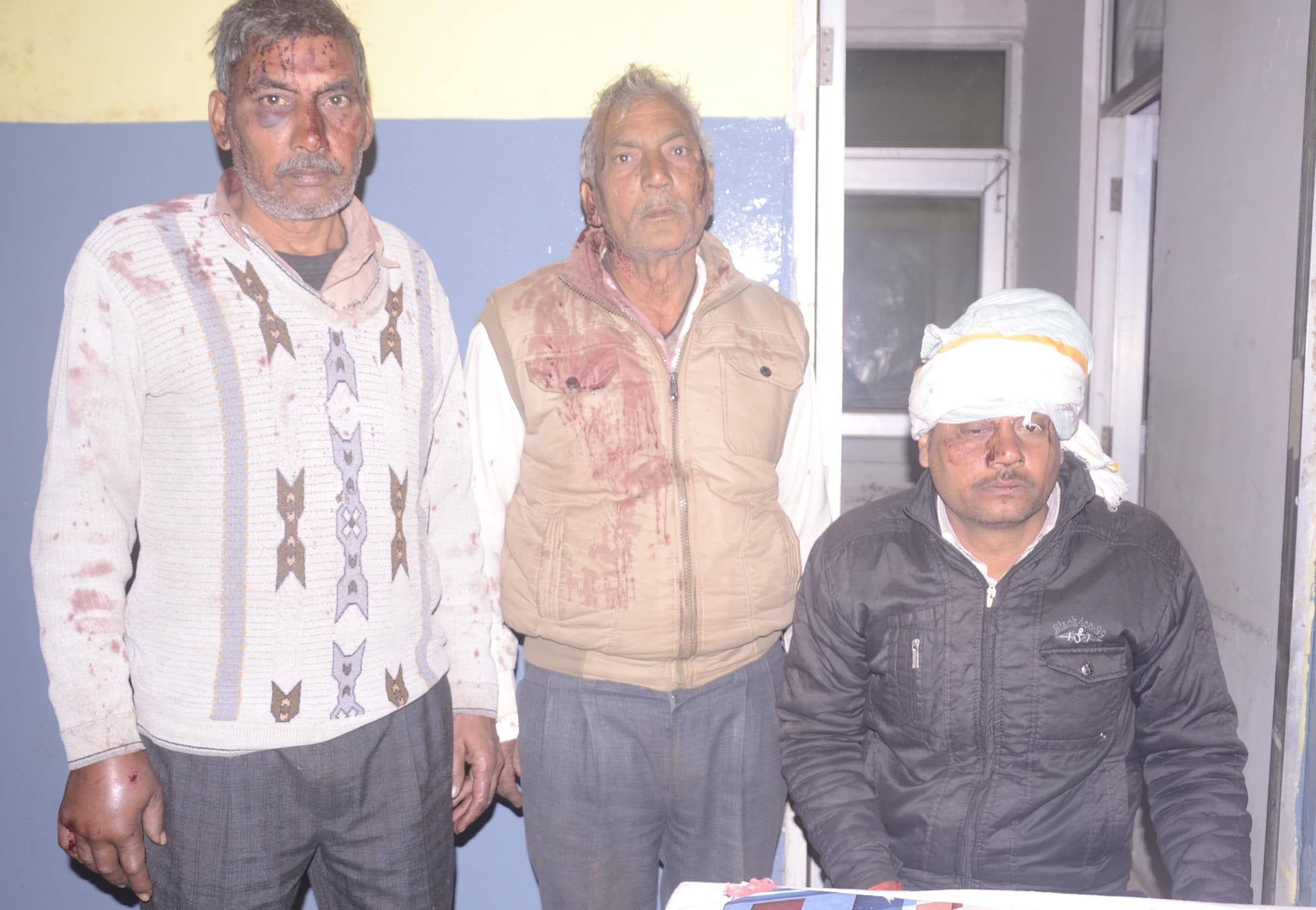 आसपुर देवसरा के बरचौली में जमीनी विवाद में मारपीट में घायल लोग।