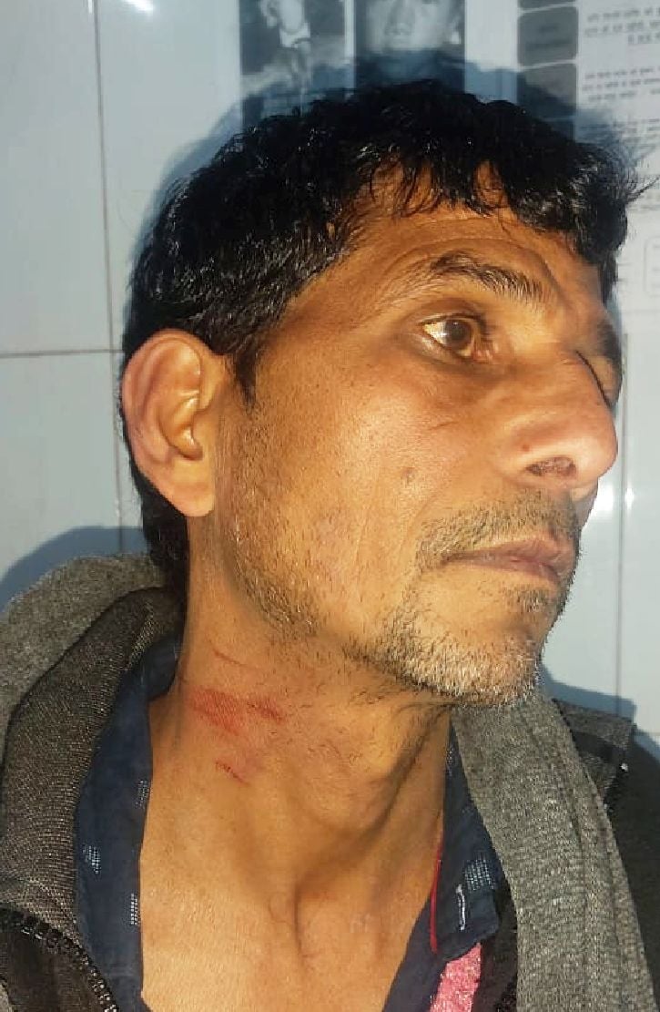 शाहजहांपुर के चिनौर में विधायक के पुत्र की मारपीट से घायल शंकर । संवाद शाहजहांपुर के चिनौर में विधायक के पुत्र की मारपीट से घायल शंकर । संवाद