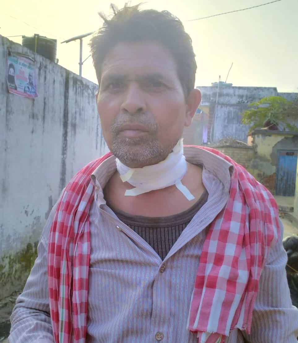 अफजलगढ़ में चीनी मांझे की चपेट में आने से घायल युवक। अफजलगढ़ में चीनी मांझे की चपेट में आने से घायल युवक।