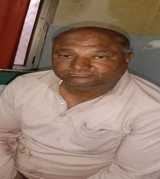  मुठभेड़ में घायल अभियुक्त जमील अहमद।