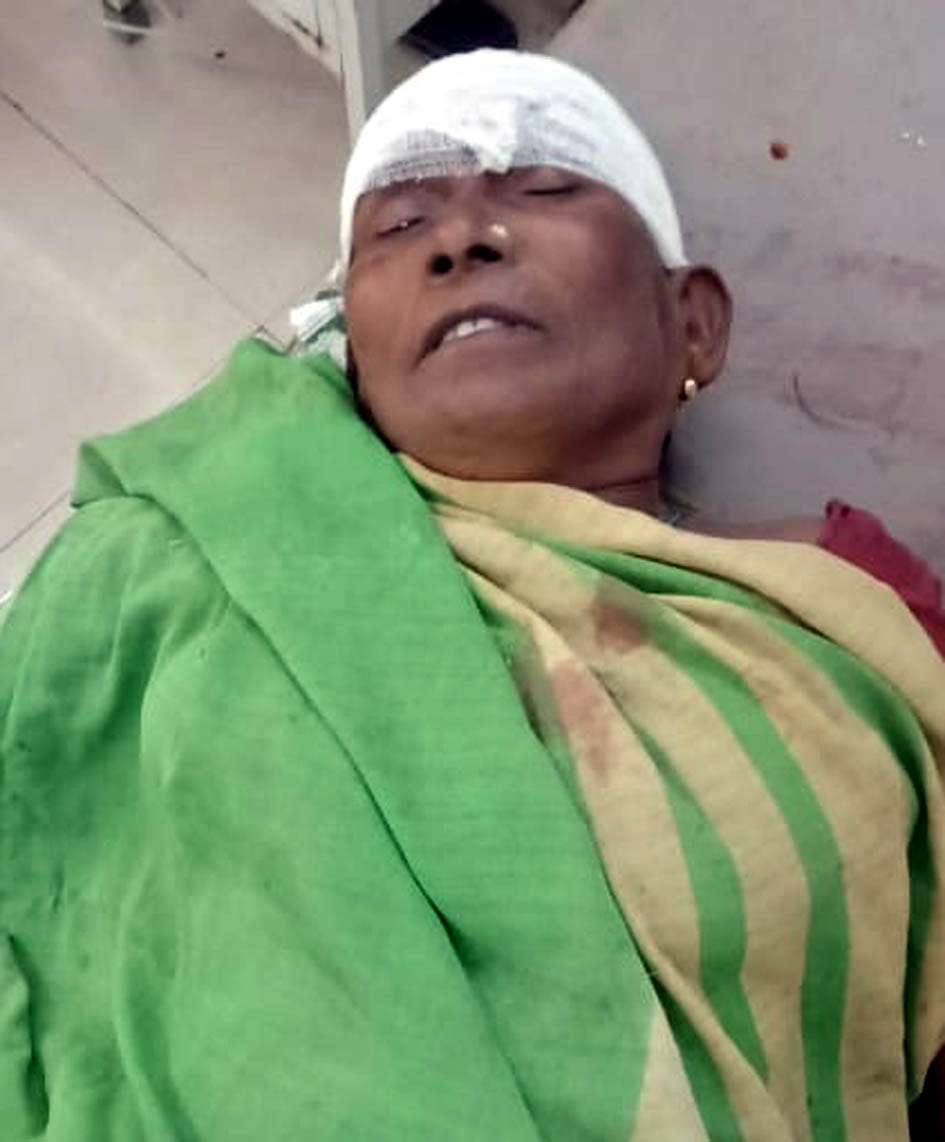 current,HT line,woman,kannauj news,scorched current,HT line,woman,kannauj news,scorched