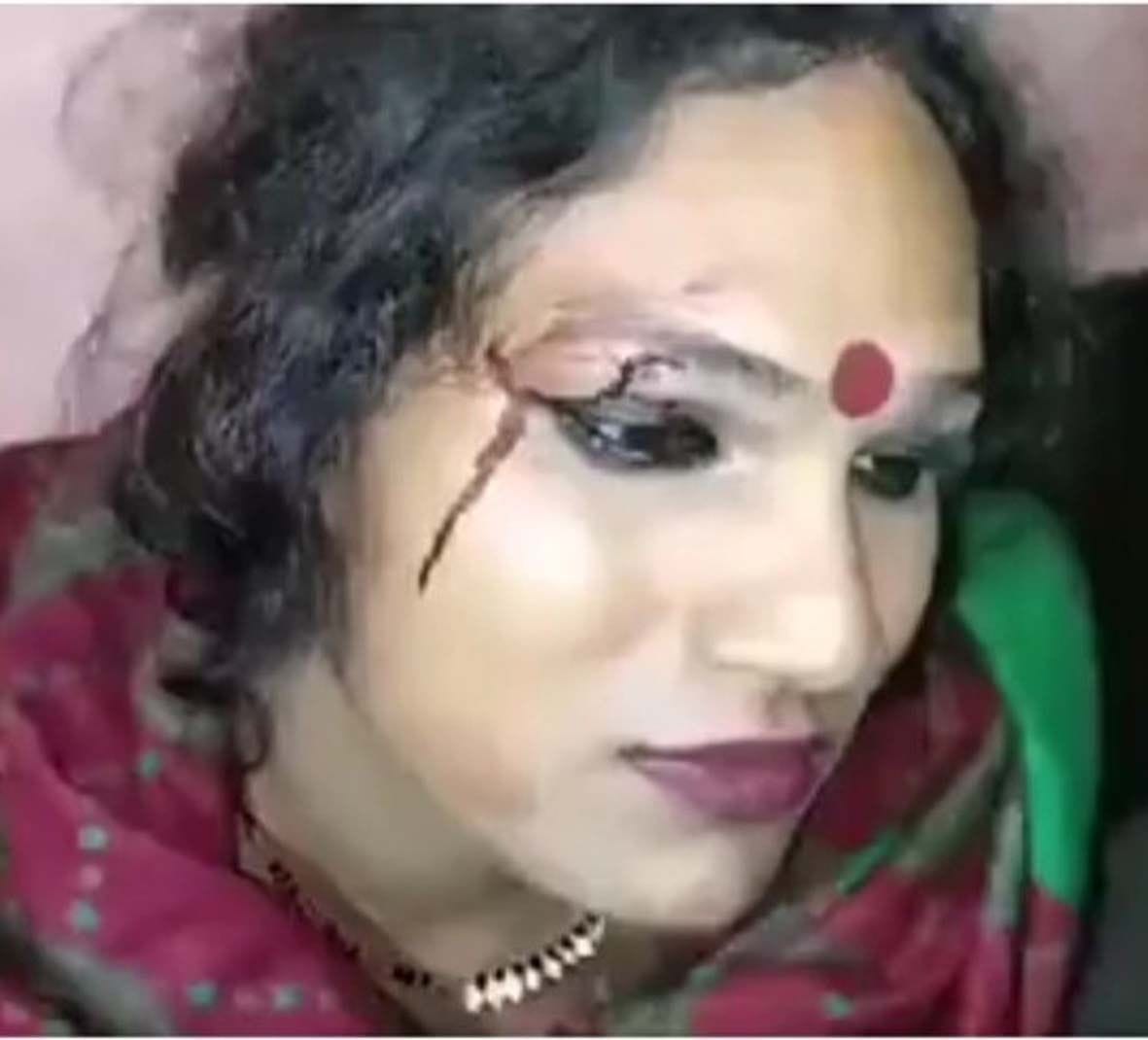 घायल किन्नर। घायल किन्नर।