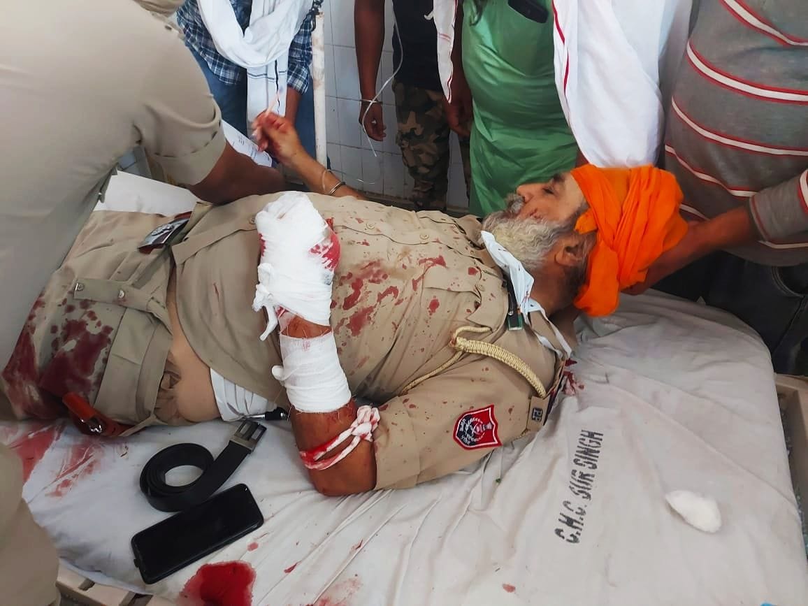 निहंग के हमले में घायल पुलिस कर्मी। निहंग के हमले में घायल पुलिस कर्मी।