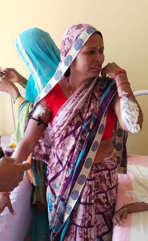 बाबा बेलखरनाथ ब्लाक के खूूझी कला गांव में रसोई गैस सिलेन्डर में आग लगने से झुलसी महिला। बाबा बेलखरनाथ ब्लाक के खूूझी कला गांव में रसोई गैस सिलेन्डर में आग लगने से झुलसी महिला।
