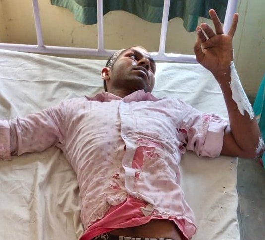 बाबा बेलखरनाथ ब्लाक के खूूझी कला गांव में रसोई गैस सिलेन्डर में आग लगने से झुलसा युवक। बाबा बेलखरनाथ ब्लाक के खूूझी कला गांव में रसोई गैस सिलेन्डर में आग लगने से झुलसा युवक।