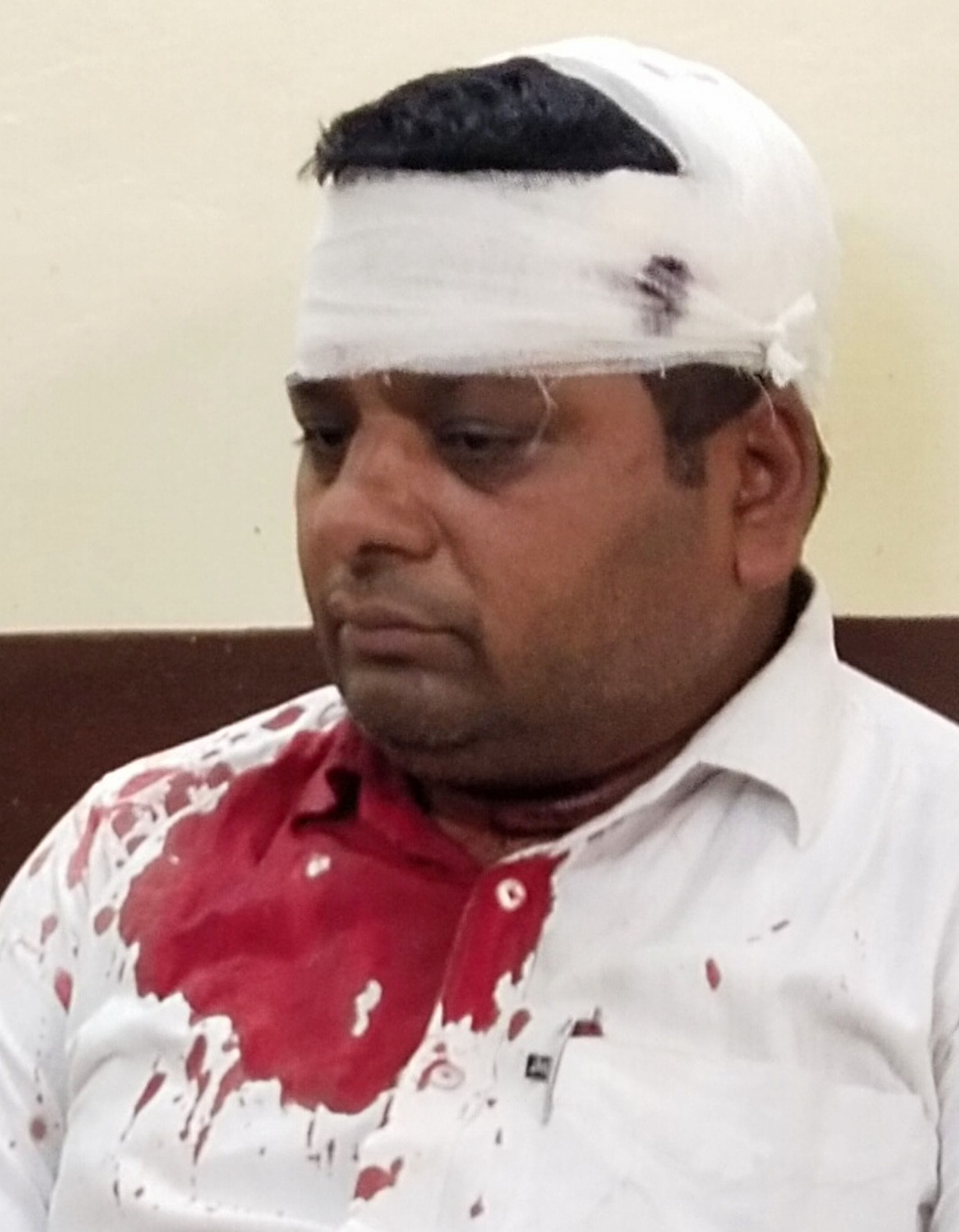 तिरगंज सरकारी अस्पताल में इलाज कराते पालिका के पंजीकृत ठेकेदार इकशाद अहमद पटौदी। तिरगंज सरकारी अस्पताल में इलाज कराते पालिका के पंजीकृत ठेकेदार इकशाद अहमद पटौदी।