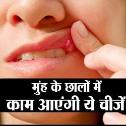 माउथ अल्सर
