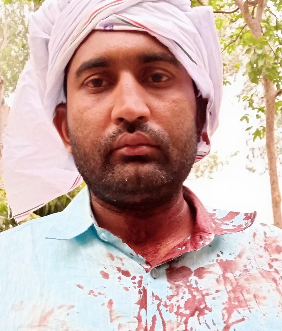 रामपुर मनिहारान के घायल रामपुर मनिहारान के घायल