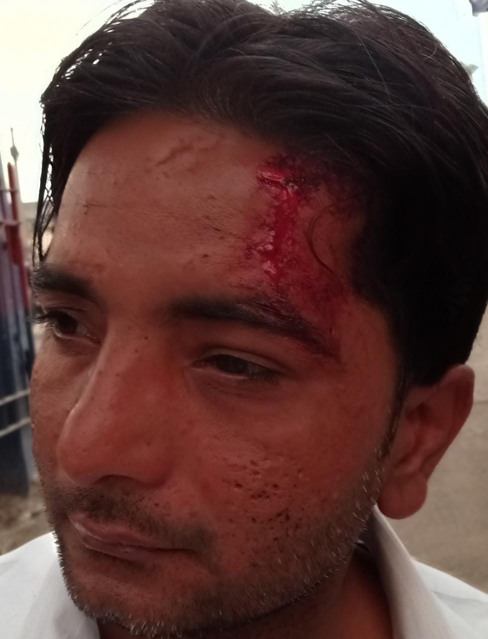 रामपुर मनिहारान के घायल रामपुर मनिहारान के घायल