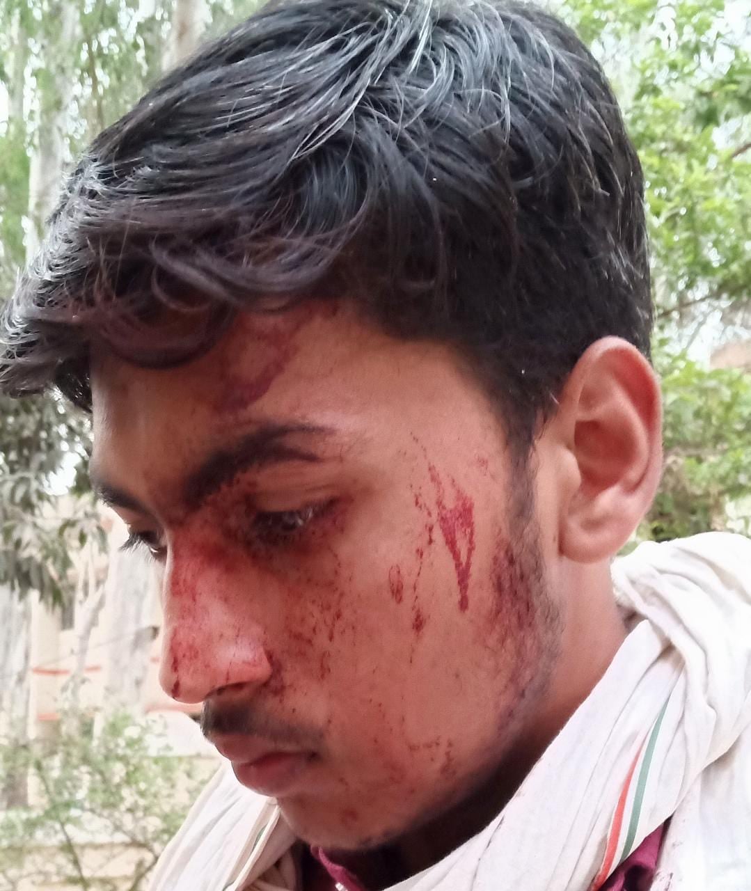 रामपुर मनिहारान के घायल रामपुर मनिहारान के घायल