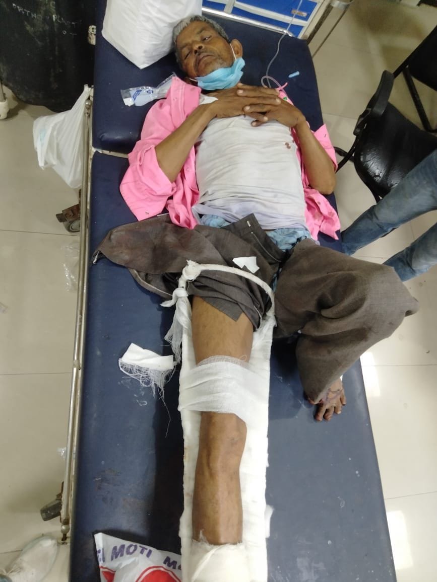 हादसे के बाद अस्पताल में उपचार कराते घायल