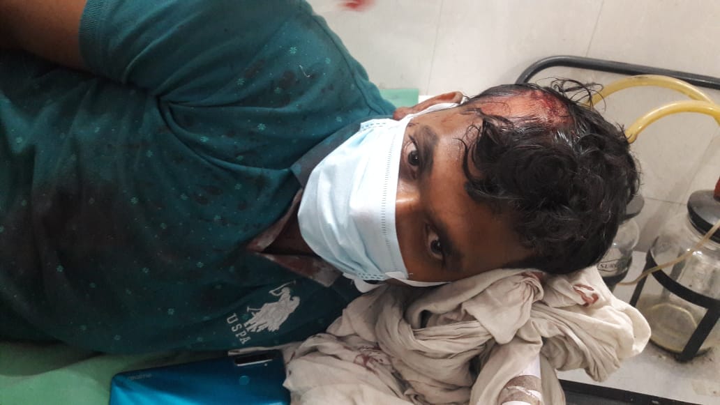 खतौली के गांव जंधेडी जाटान में मारपीट में घायल व्यक्ति। खतौली के गांव जंधेडी जाटान में मारपीट में घायल व्यक्ति।