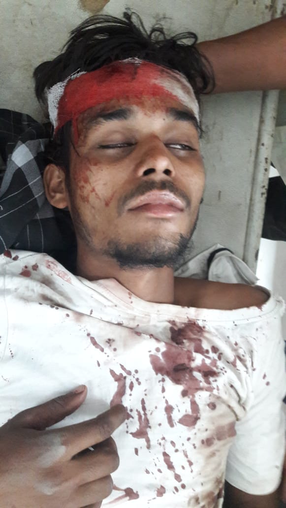 खतौली के गांव जंधेडी जाटान में मारपीट में घायल व्यक्ति। खतौली के गांव जंधेडी जाटान में मारपीट में घायल व्यक्ति।