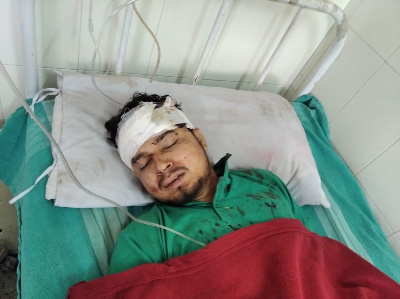 अस्पताल में भर्ती दुर्घटना का एक घायल। अस्पताल में भर्ती दुर्घटना का एक घायल।
