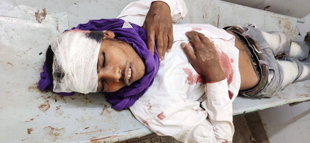 फोटो-22एयूआरपी-10- से 14 तक घायल