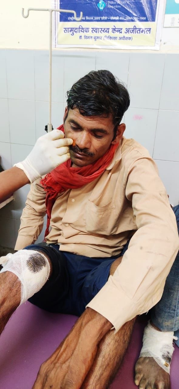 फोटो-22एयूआरपी-14