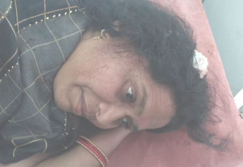 बस पलटने में घायल महिला। संवाद बस पलटने में घायल महिला। संवाद